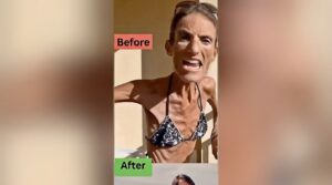 Doctors Were Worried About Her Condition—Then an Unexpected Turn Changed Everything