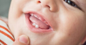 Why Saving Your Child’s Baby Teeth Could Be Important for Future Medical Advances