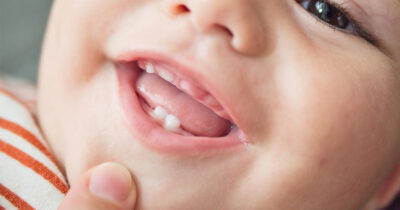 Why Saving Your Child’s Baby Teeth Could Be Important for Future Medical Advances